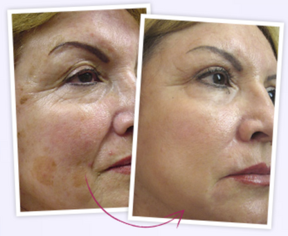 dsad (PE) 3